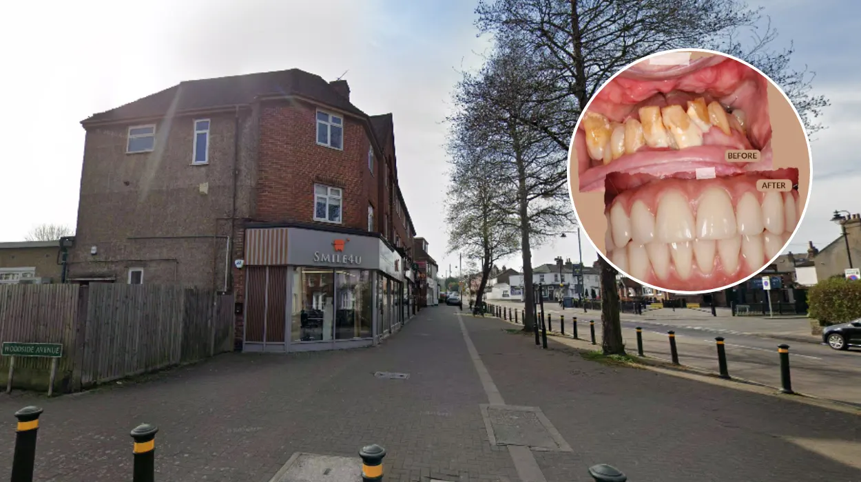 Smile 4 U Bromley: Root Canal Consultations Now Open