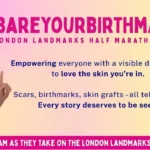 Women Bare Birthmarks at London Half Marathon to Challenge Congenital Naevus Stigma