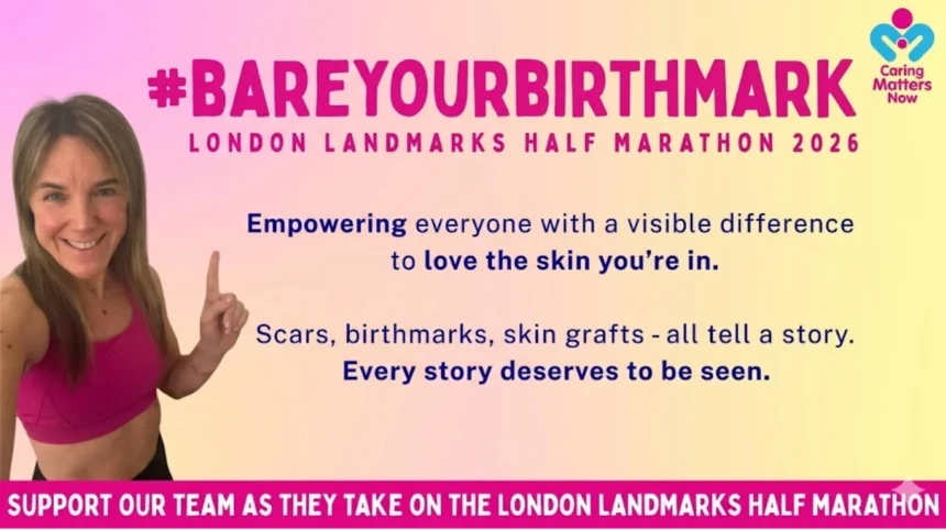 Women Bare Birthmarks at London Half Marathon to Challenge Congenital Naevus Stigma