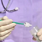 London’s Cervical Self-Swab Rollout: Could It Help Women Who Avoid Screening?