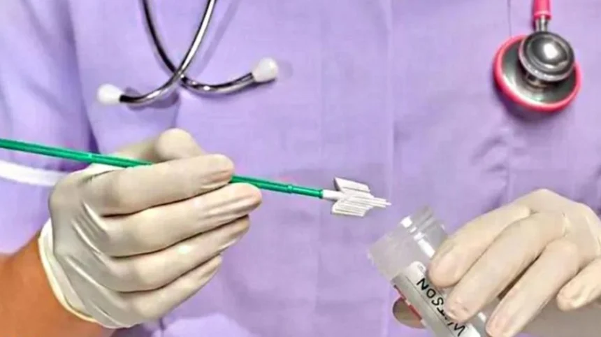 London’s Cervical Self-Swab Rollout: Could It Help Women Who Avoid Screening?